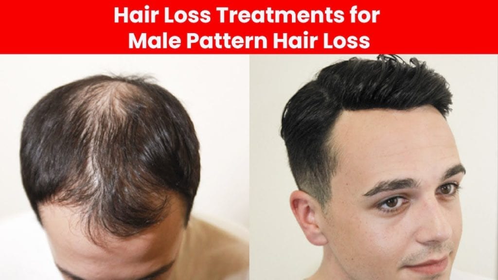 What Causes Hair Loss and What Supplement Will Stop it?