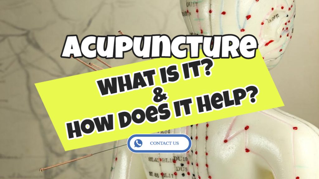 What Exactly is Acupuncture and How Does Acupuncture Work?